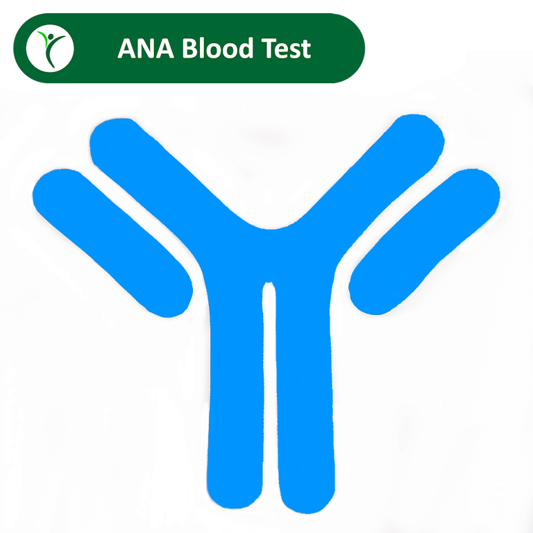 ANA blood test