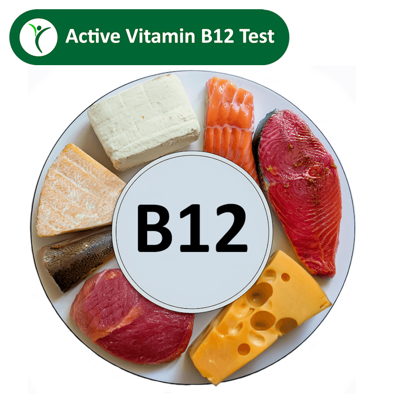 Active Vitamin B12 Test