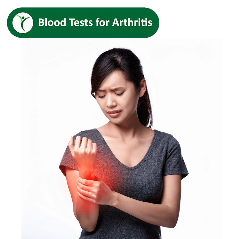 Blood Tests for Arthritis