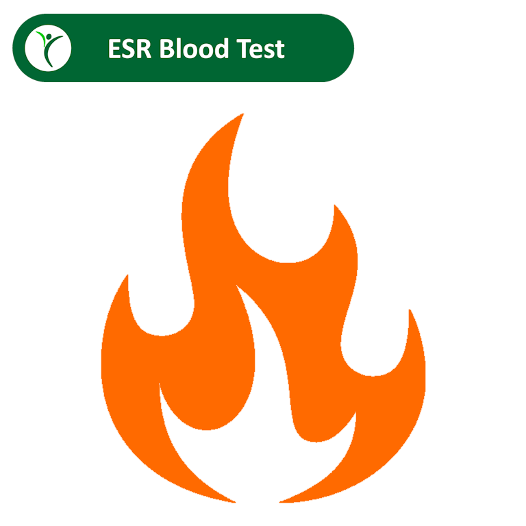 ESR blood test