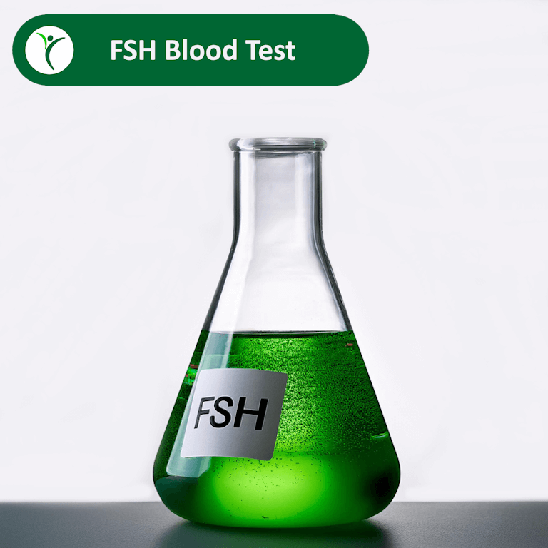 FSH Blood Test showing lab flask with green fluid