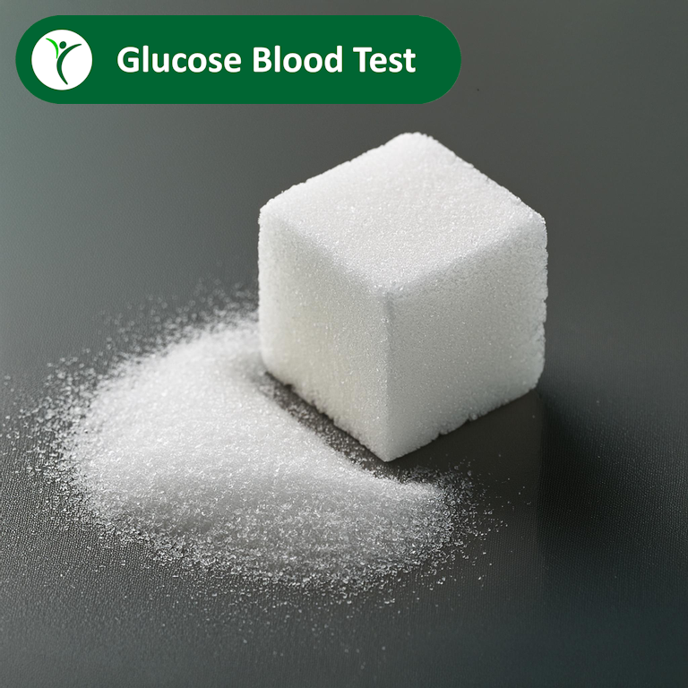 Glucose Blood Test