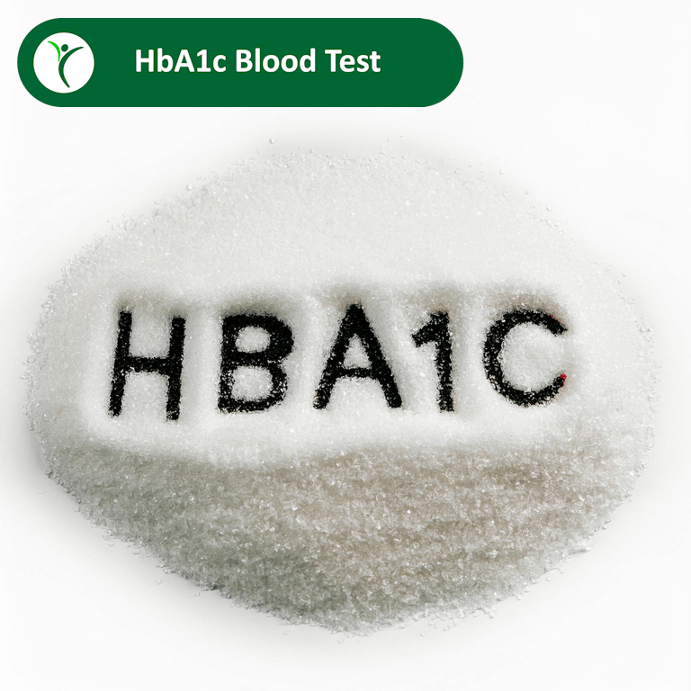 HbA1c Blood Test