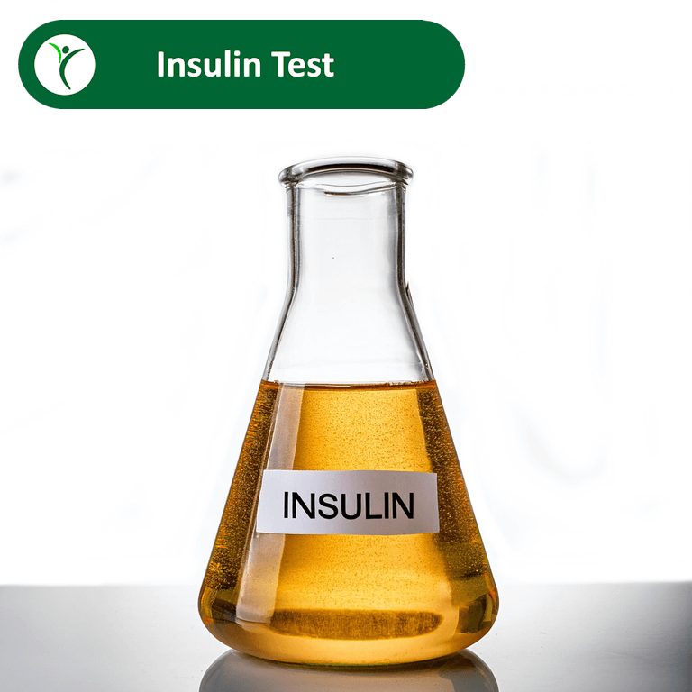 Insulin Test