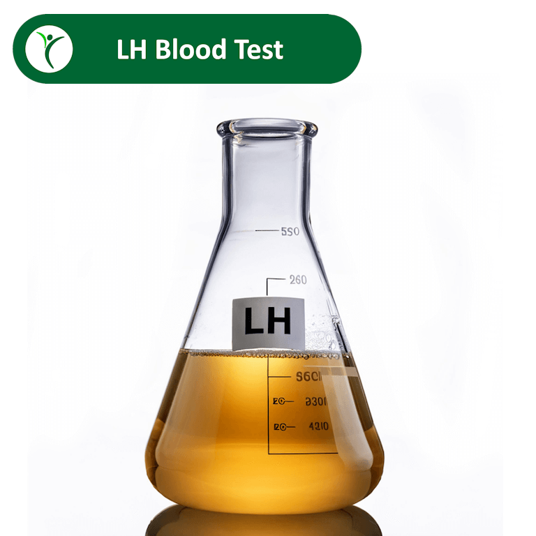 LH Blood Test depicted by light orange fluid in lab flask