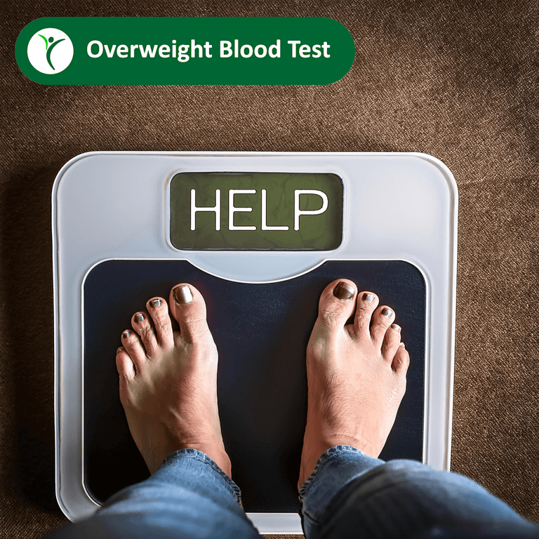 Overweight Blood Test