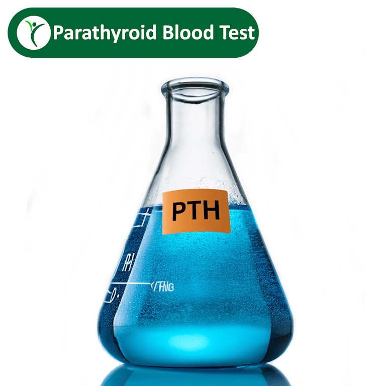 PTH-parathyroid-hormone-blood-test depicted by blue fluid in lab flask