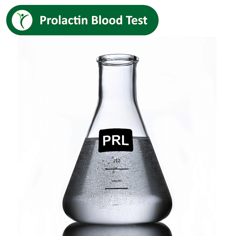 Prolactin blood test depicted by a grey fluid in a lab flask