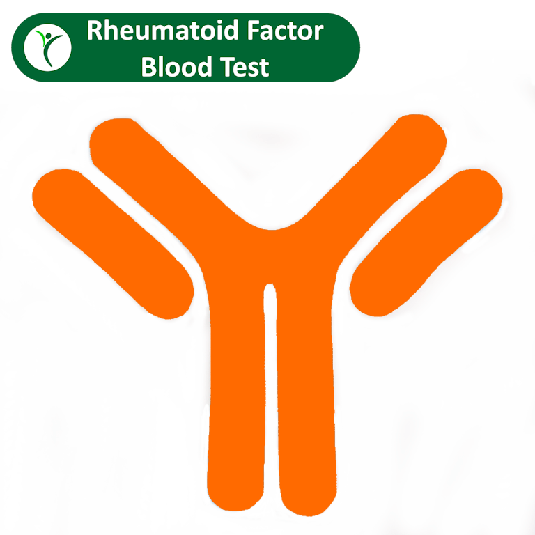 Rheumatoid Factor (RF) Blood Test | Rheumatoid Arthritis Check – AIS ...