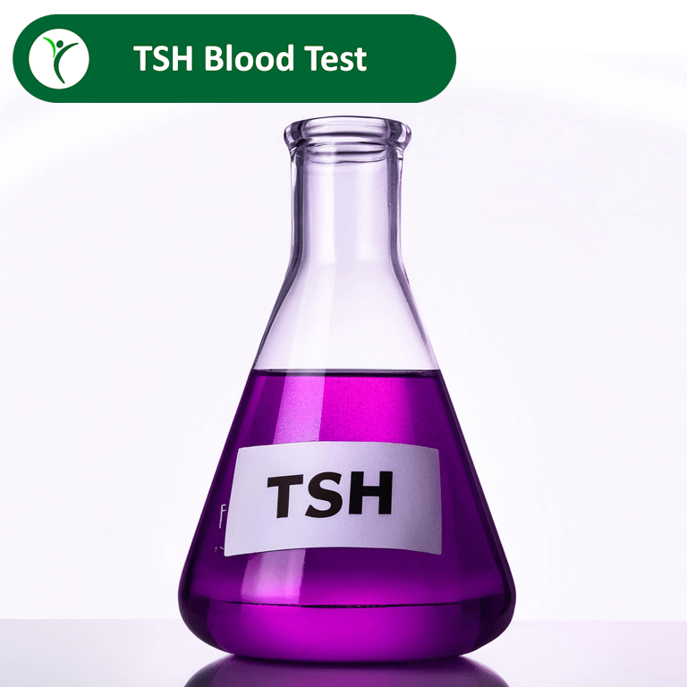 TSH blood test depicted by a purple liquid in a lab flask