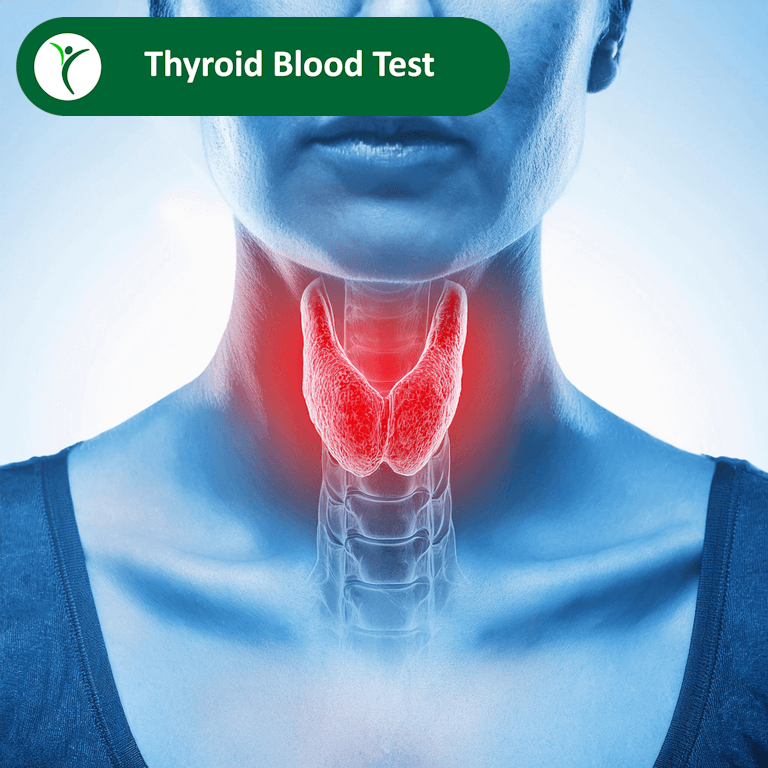 Thyroid Blood Test