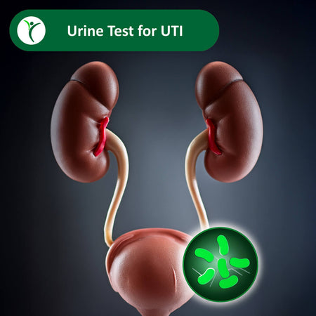 kidneys and bladder with bacterial elements nearby signifying UTI