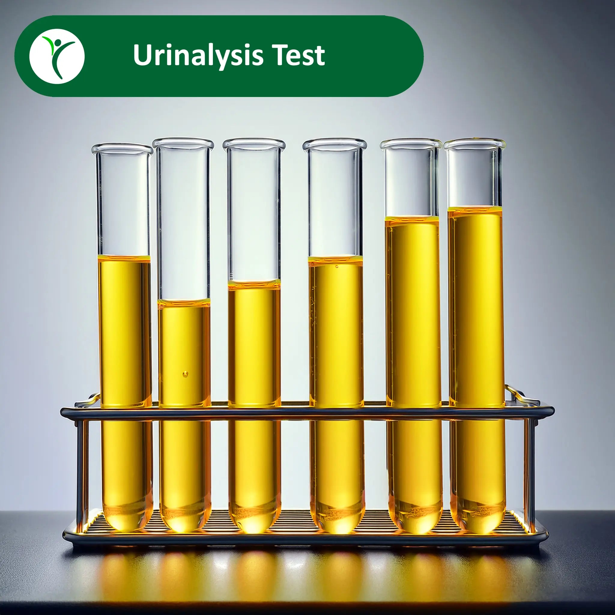 Test tubes in a rack containing urine